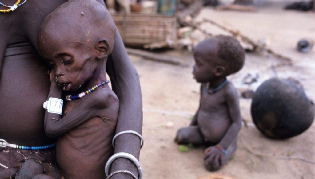 Worst Food Crisis In The History Of South Sudan Sudan Relief Fund   Alamy Acxgxt Sudan Malnourished 1 1024x583 